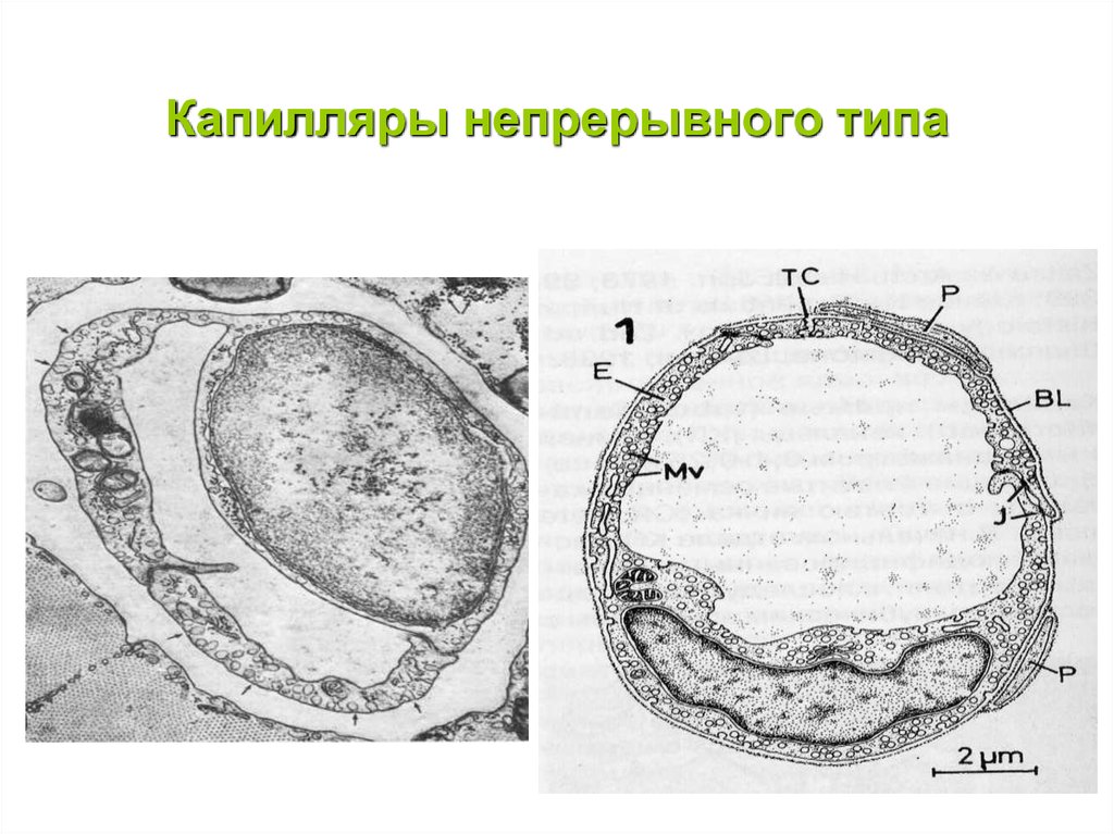 Клетки капилляров. Капилляр непрерывного типа гистология. Капилляр непрерывного типа эм. Капилляр непрерывного типа эм гистология. Капилар непрерывного типа.