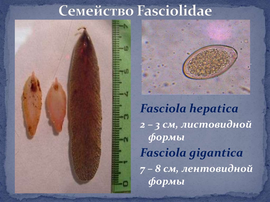 Листовидная форма червей. Марита Fasciola hepatica строение. Fasciola Gigantica яйца. Fasciola hepatica яйца. Fasciola Gigantica строение.