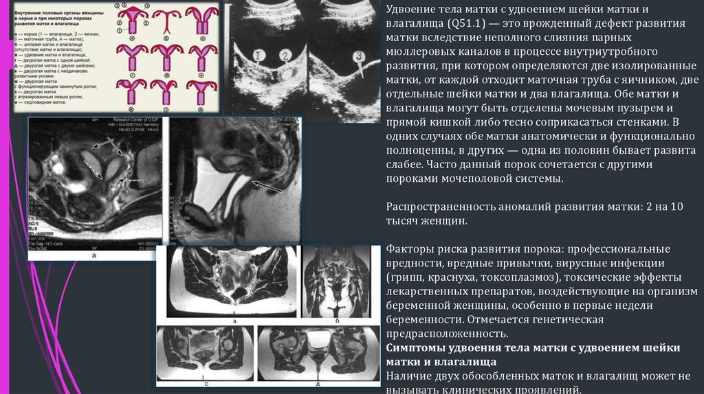 Фото аномалии развития женских половых органов