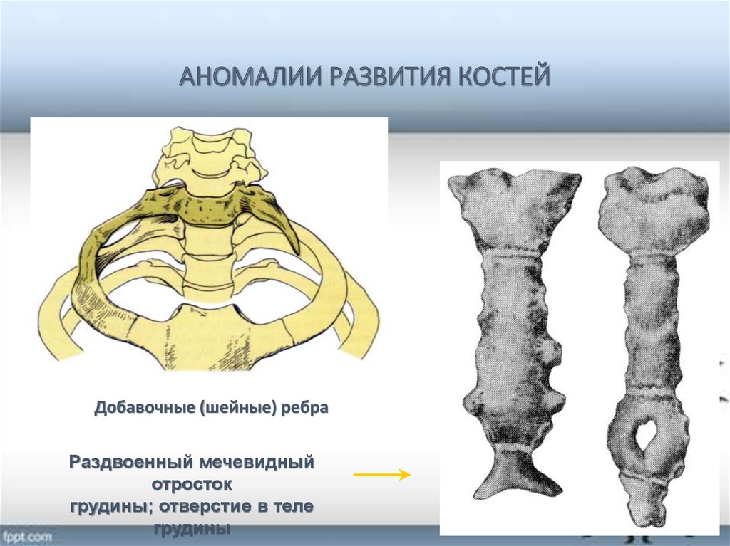 Пороки развития опорно двигательного аппарата презентация