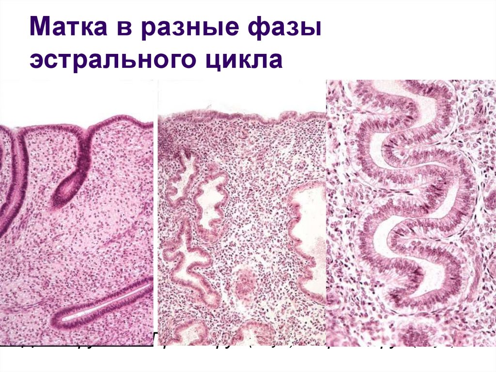 Матка гистология. Матка в разных фазах гистология. Эстральный цикл. Цикл развития матки гистология. Матка женщины гистология.