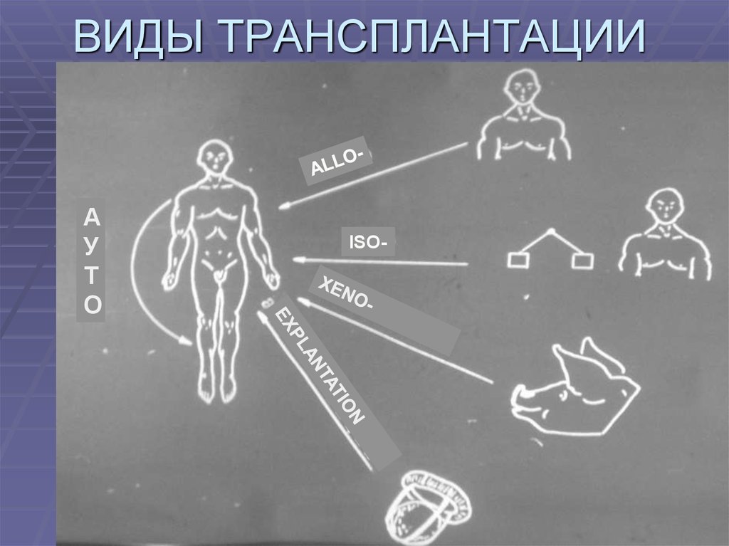 Виды трансплантации презентация