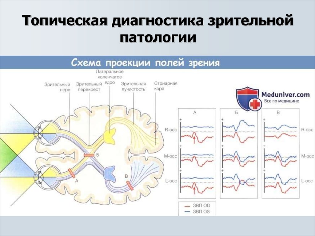 Зрительные вызванные потенциалы