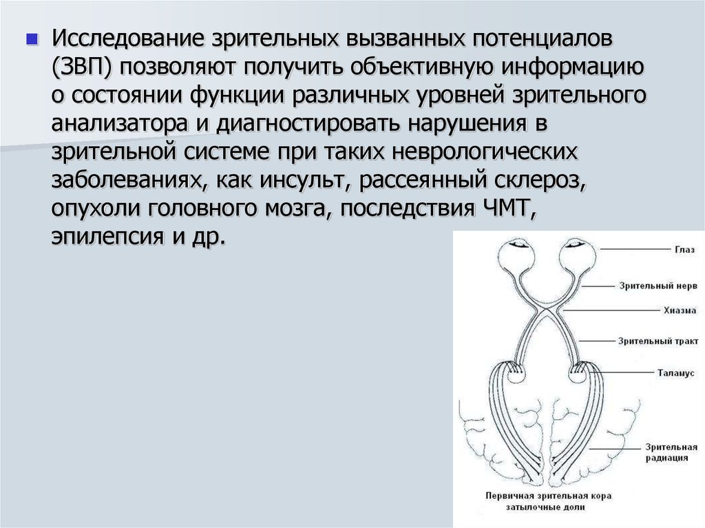 Зрительные вызванные потенциалы