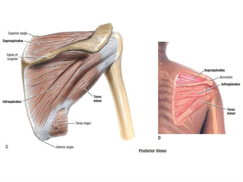 Алкоголизация Supraspinatus