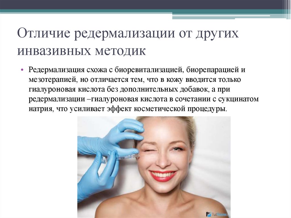 Отличие редермализации от других инвазивных методик