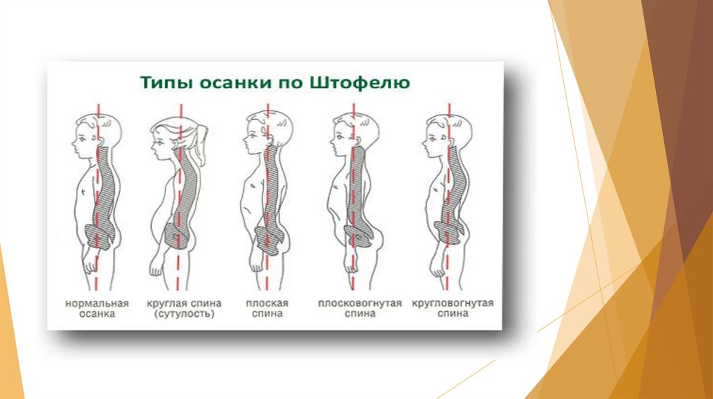 Роль физических упражнений в формировании осанки школьников презентация