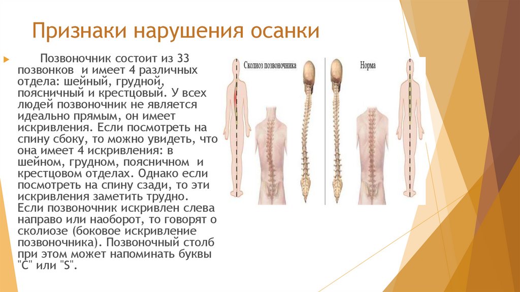 Роль физических упражнений в формировании осанки школьников презентация