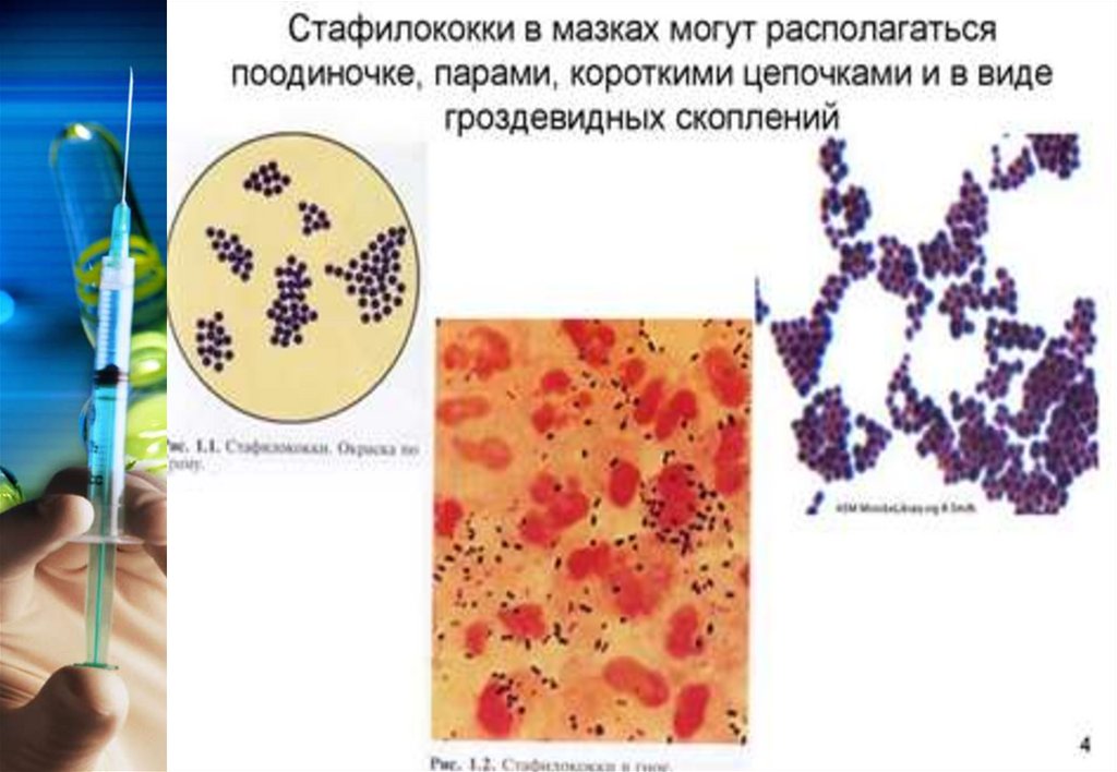 Стафилококк виды. Стафилококк ауреус мазок. Стрептококк ауреус. Микрококки стрептококки тетракокки стафилококки. Золотистый стафилококк мазок.