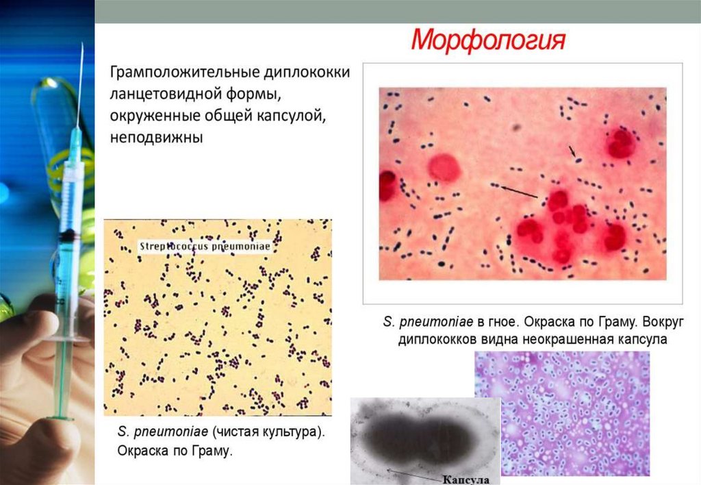 Пневмококки микробиология презентация