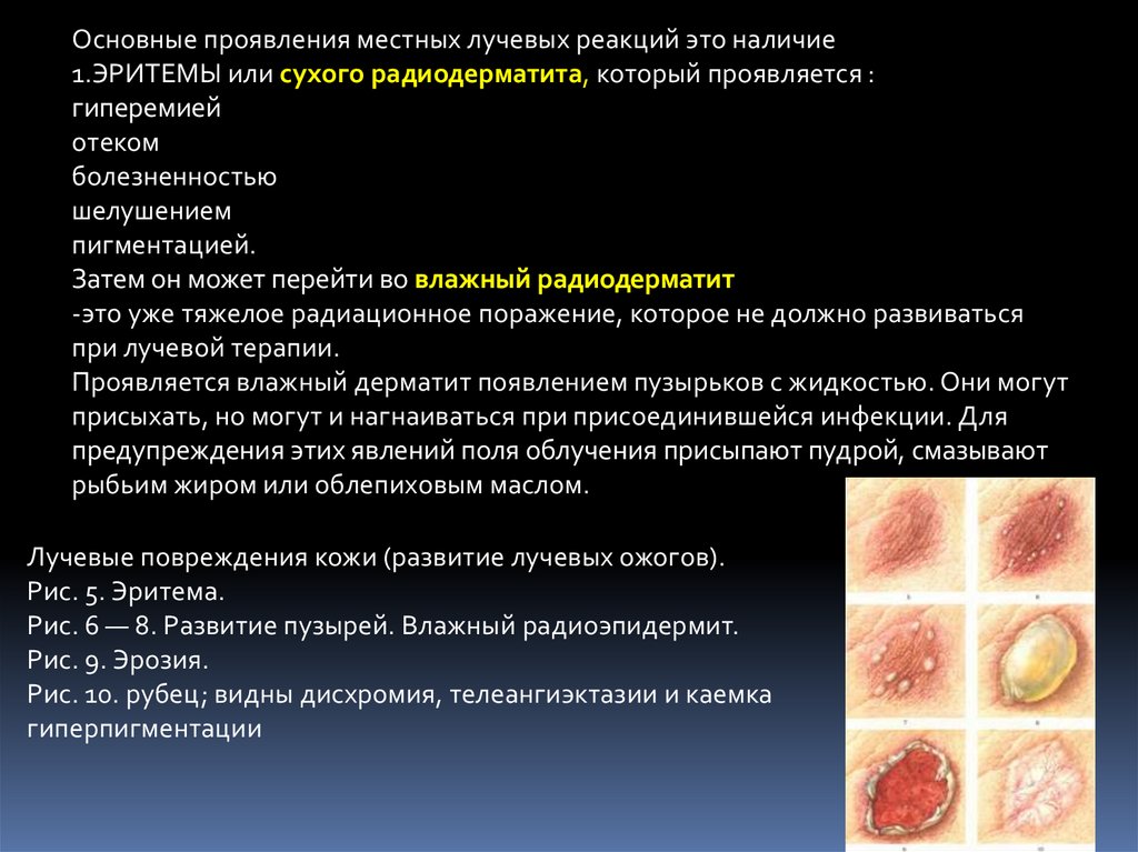 Планирование лучевой терапии презентация