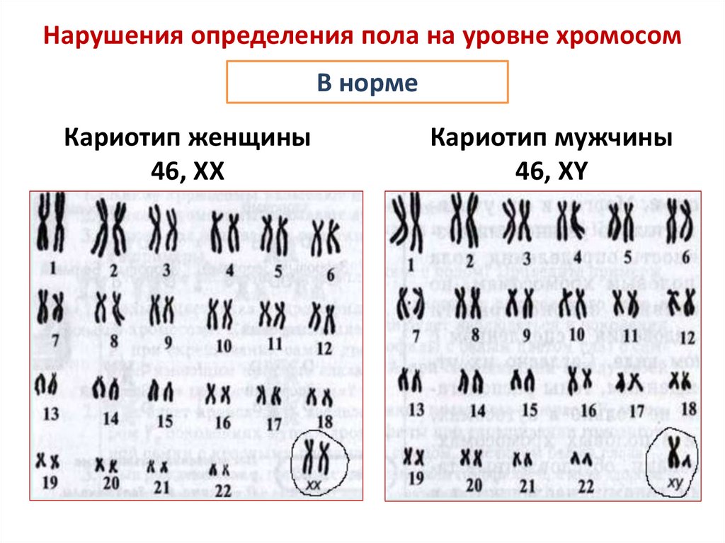 Где кариотип. Кариотип мужчины и женщины. Уровни хромосом. Кариотип 46хх расшифровка. Установите кариотип и определите пол..