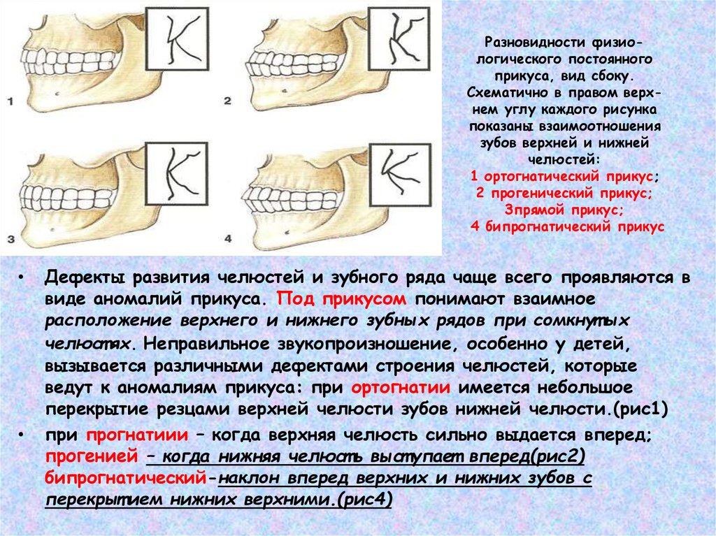 Правильное смыкание зубов схема