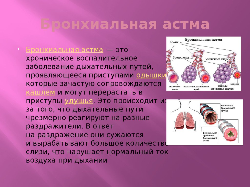 Астма и бронхиальная астма в чем разница. Бронхиальная астма. Легкие астматика. Бронхиальная астма презентация. Бронхиальная астма понятие.