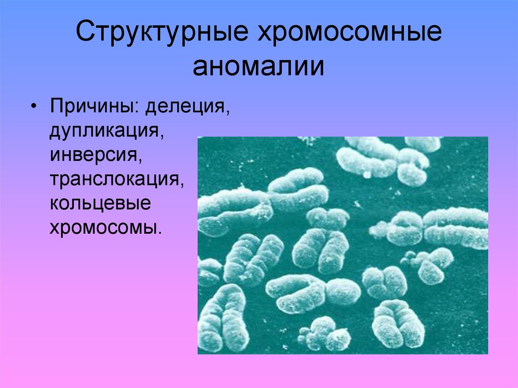 Хромосомные болезни человека презентация