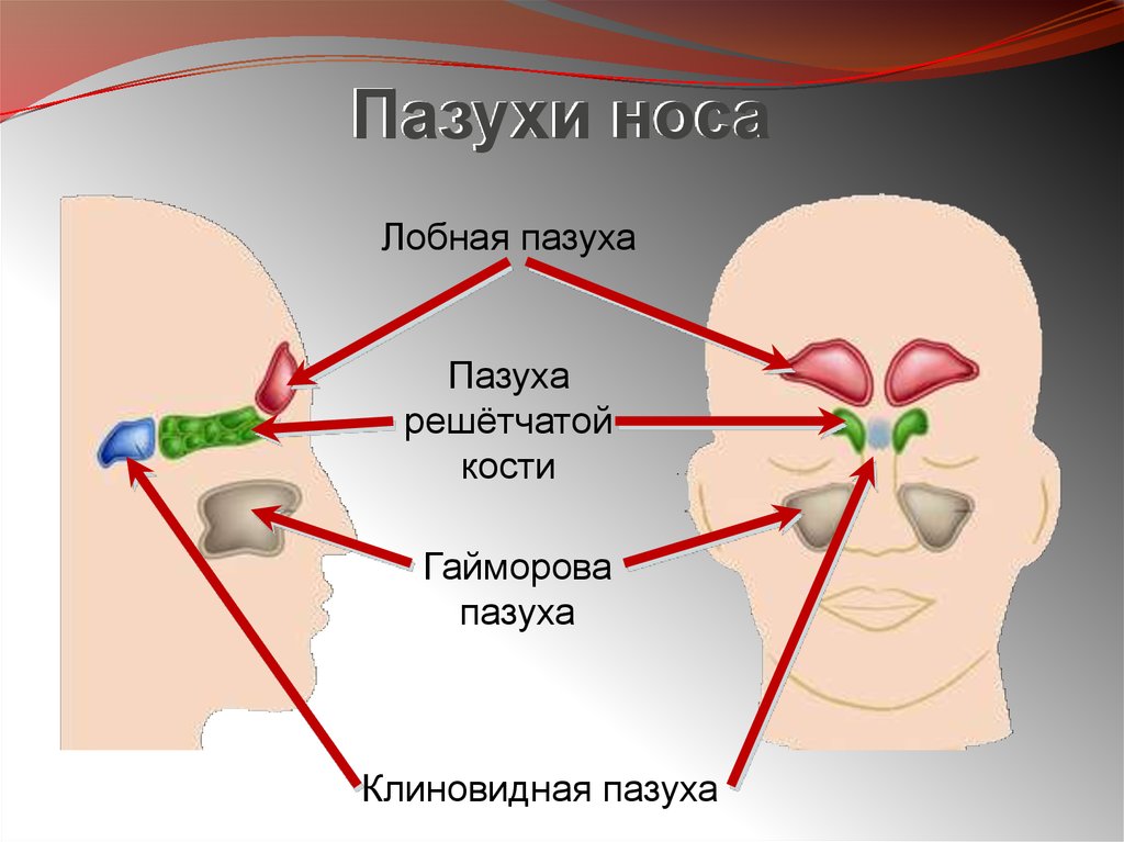 Гайморит презентация