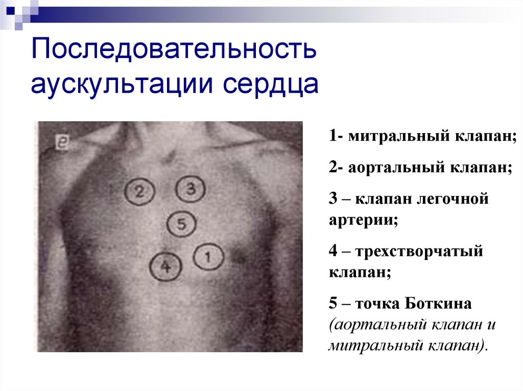 Аорта выслушивается. Точки выслушивания клапанов сердца. Точки выслушивания клапанов аускультация сердца. Точки аускультации клапанов сердца (5 точек). Какова последовательность аускультации клапанов сердца?.