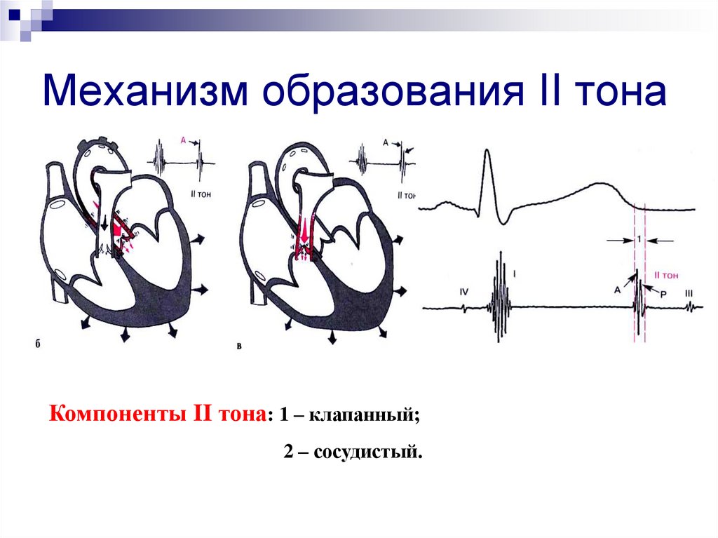 Звук тонов сердца. Механизм образования 2 тона сердца. Механизм образования первого тона сердца. Механизм образования 1 и 2 тонов сердца. Механизм образования II тона.