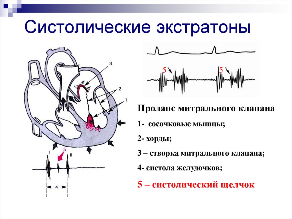 Тоны сердца схема