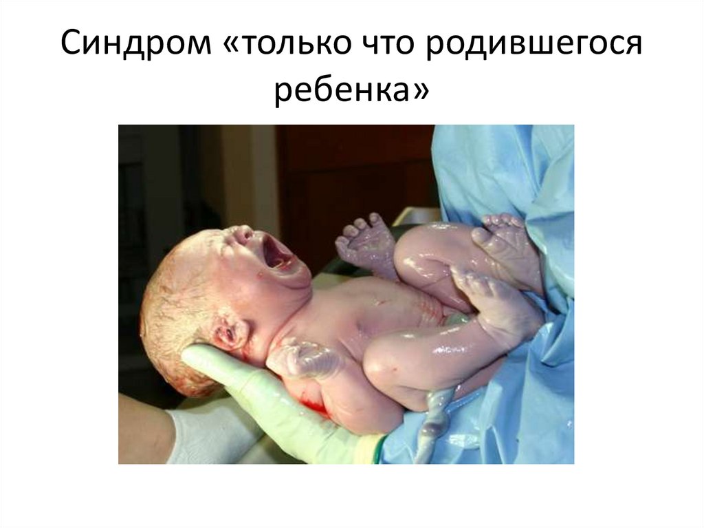 Пограничные (транзиторные) состояния у новорожденных