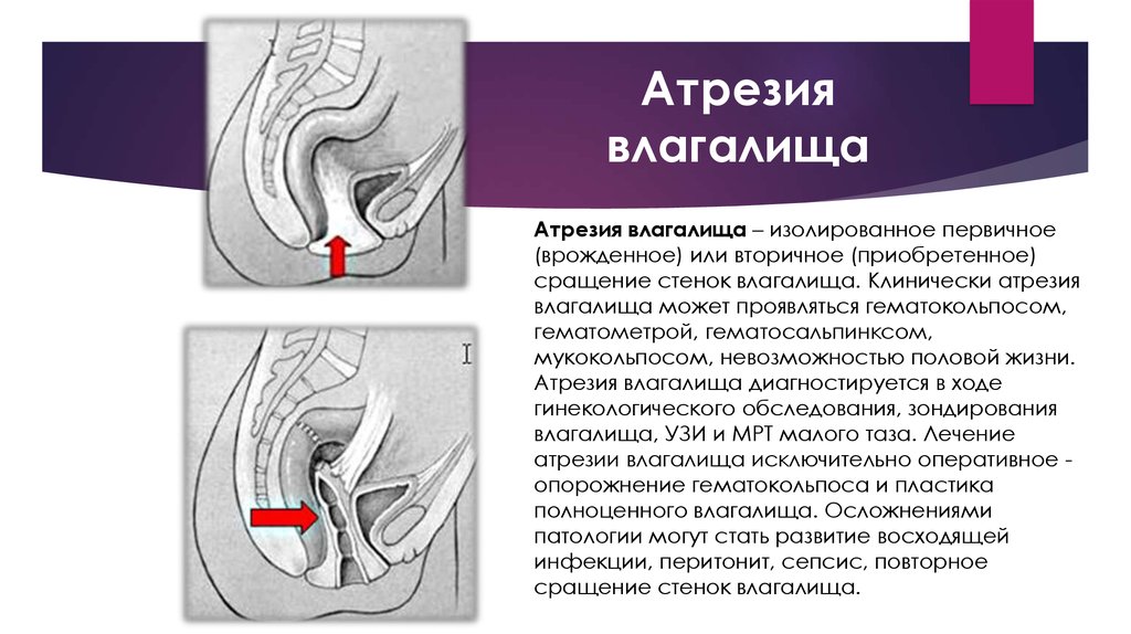 Анатомия женских половых органов. Киев, Печерск | 