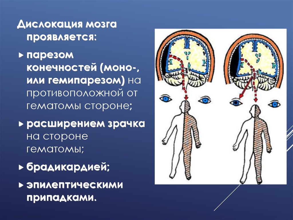 Созревание мозга происходит