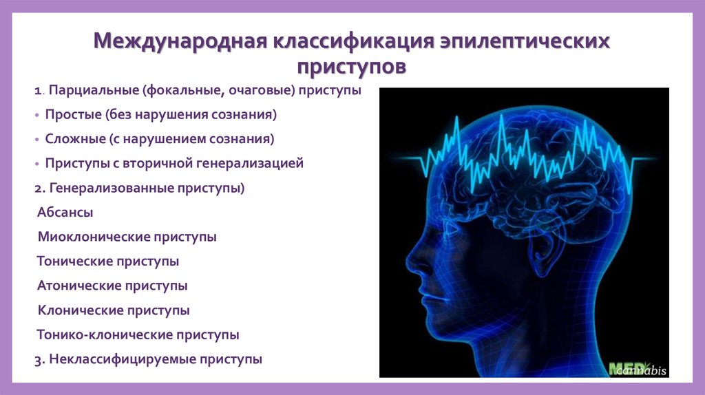 Эпилептический припадок сознание