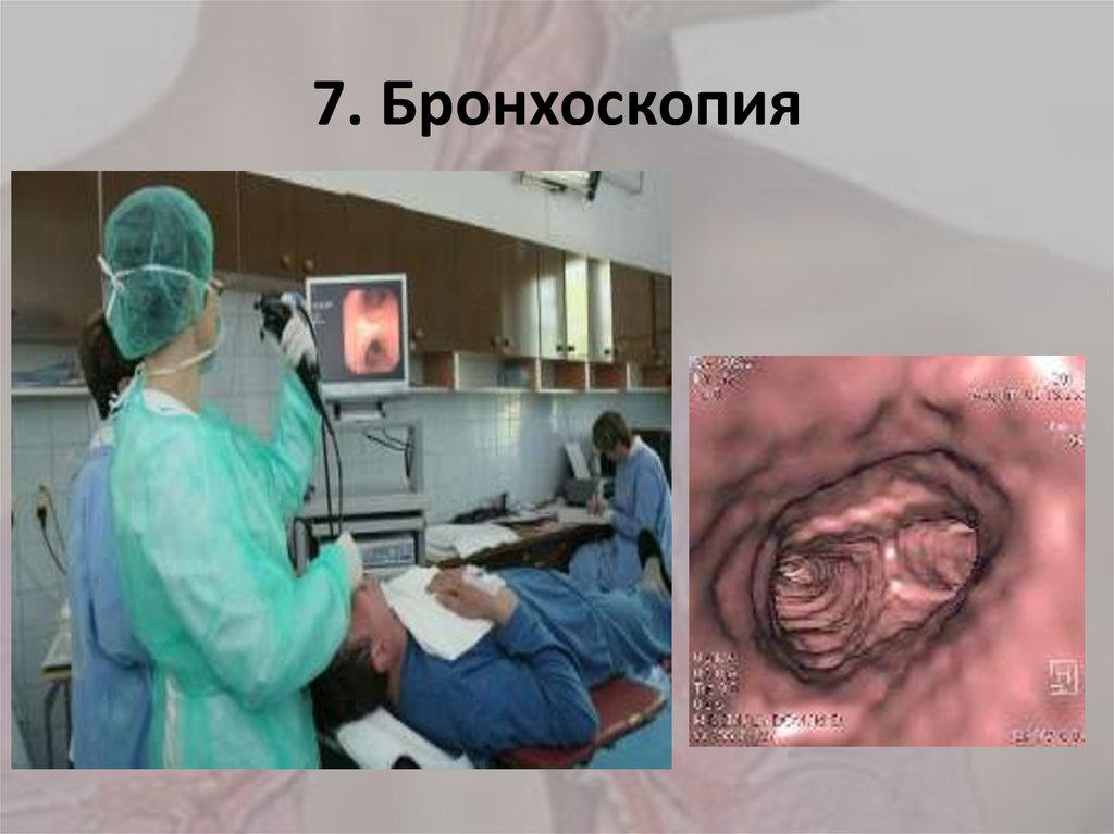7. Бронхоскопия
