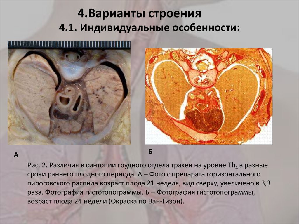 4.1. Индивидуальные особенности: