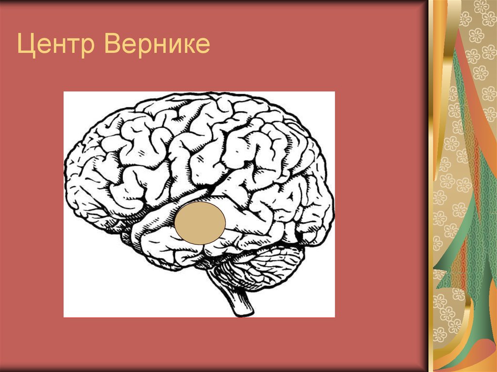 Зона брока и вернике. Центр Вернике. Центр Брока и Вернике функции. Сенсорная алалия центр Вернике.