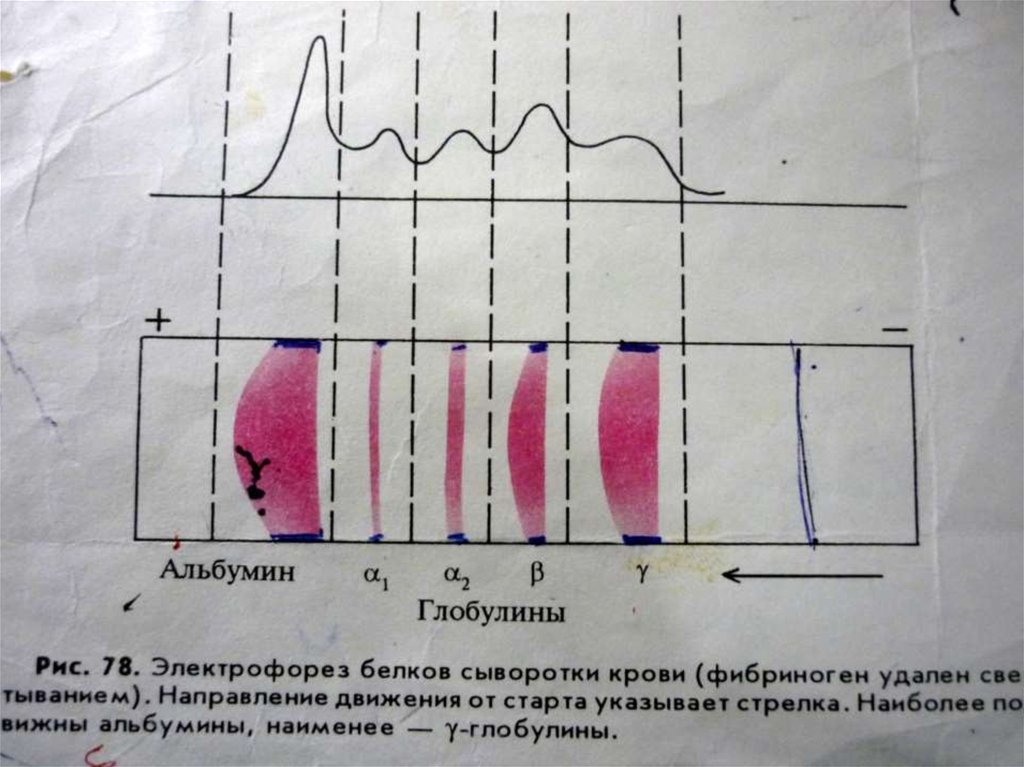 Разделение белков сыворотки крови. Электрофореграмма белков сыворотки крови. Белковые фракции методом электрофореза. Разделение белковых фракций крови методом электрофореза. Электрофорез белковых фракций крови.