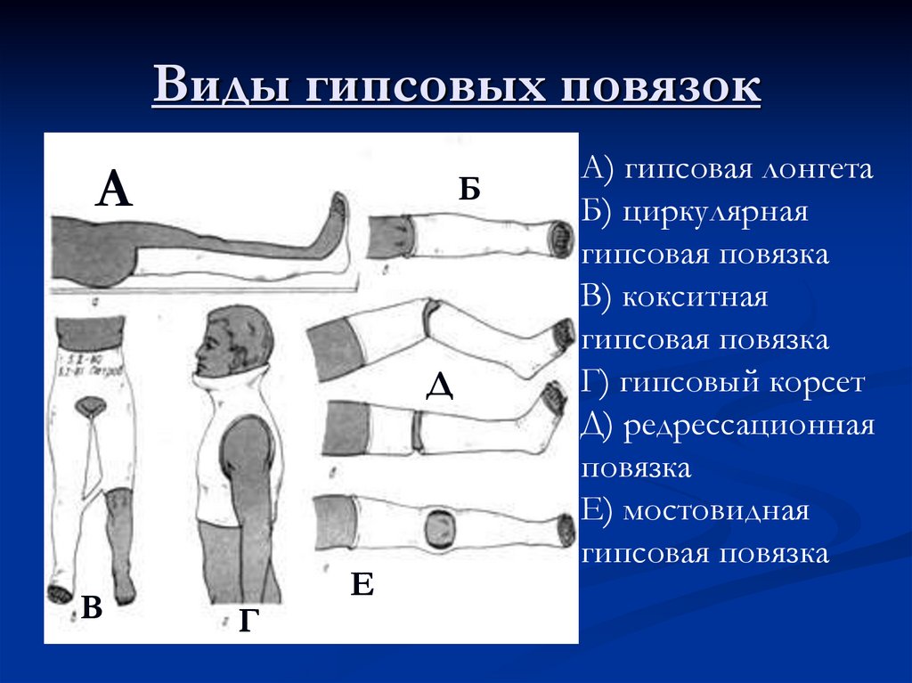 Переломы верхних конечностей презентация