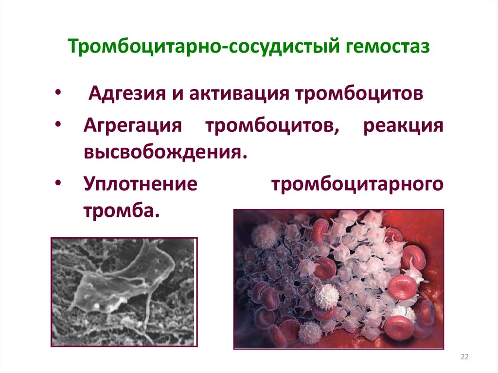 Патология гемостаза презентация