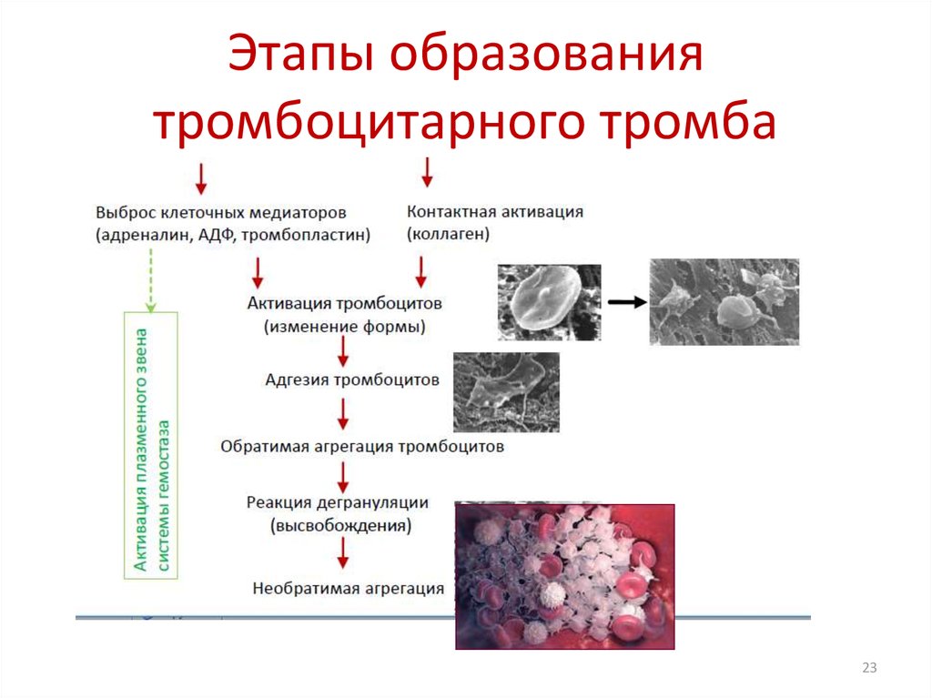 Образование тромба схема егэ