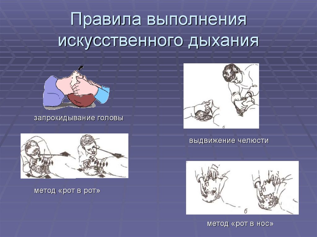 Первая помощь при отсутствии кровообращения презентация