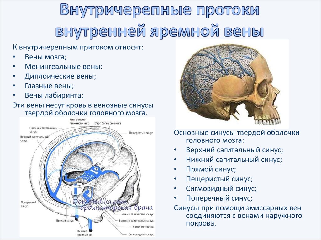 Гипоплазия правого поперечного синуса. Внутричерепной внутренняя яремная Вена. Внутричерепные вены внутренней яремной. Синусы головного мозга анатомия. Внутренняя яремная Вена внечерепные притоки.