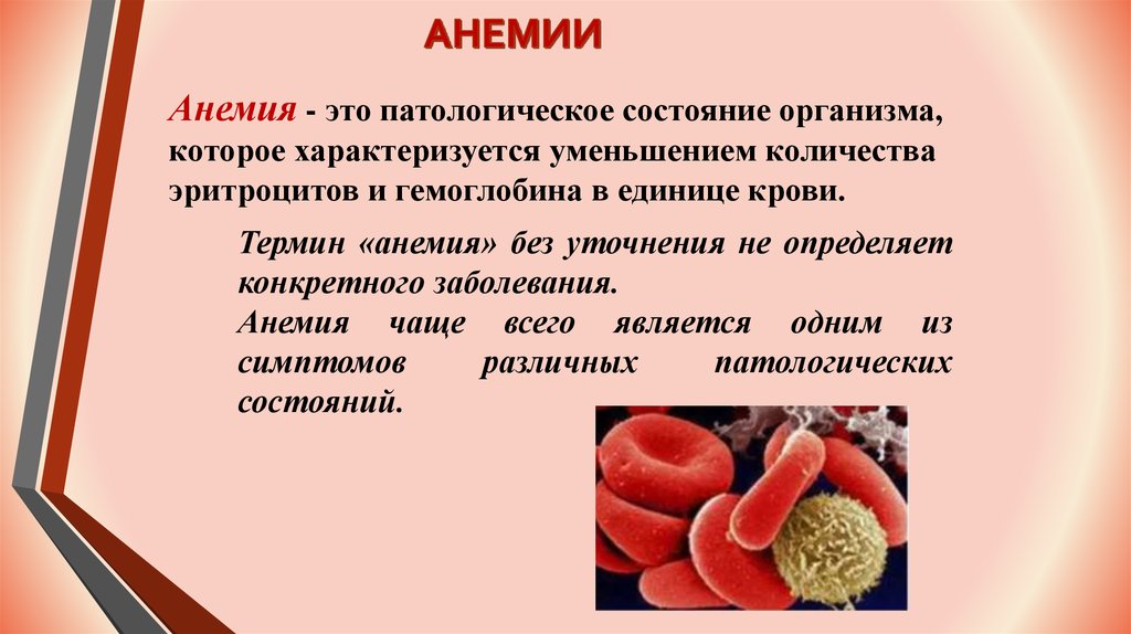 Системная анемия. Внешние проявления анемии.