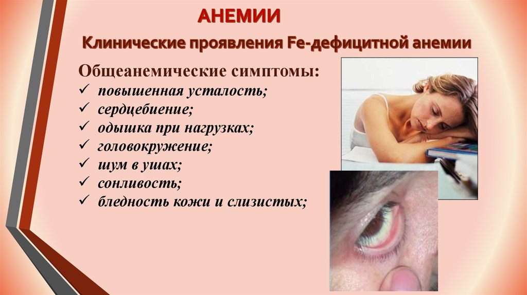 Анемия ухо. Низкий гемоглобин симптомы. Признаки низкого гемоглобина.