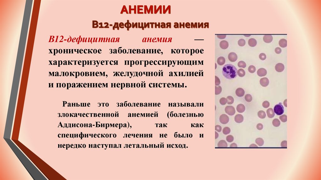 Малокровие причины заболевания. Б12 дефицитная анемия кровь. Анемия при в12 дефицитной анемии. В12-пернициозная анемия. В12 дефицитная анемия презентация.