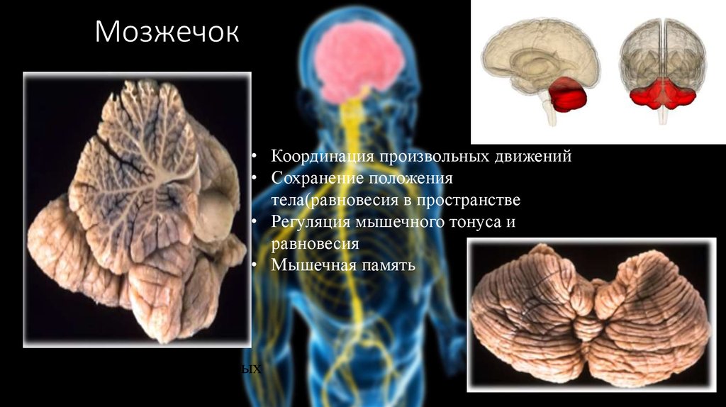 Изменение мозжечка. Мозжечок.