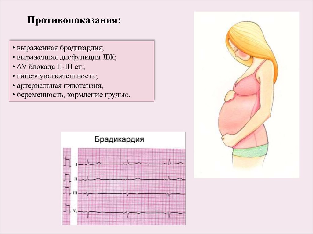 Блокада противопоказания. Брадикардия беременной на 9 месяце беременности.