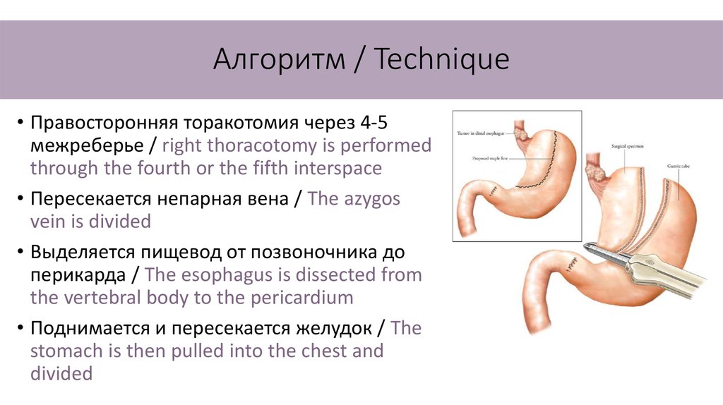 Операция герлока схема