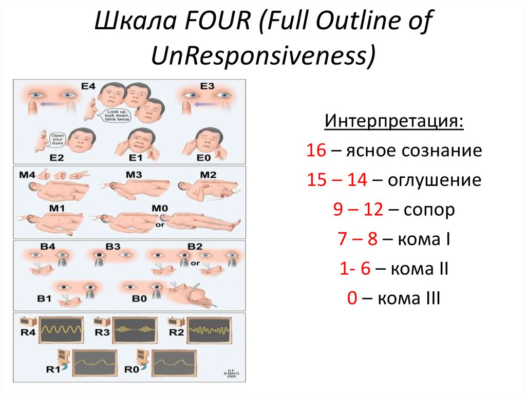 Шкала four калькулятор