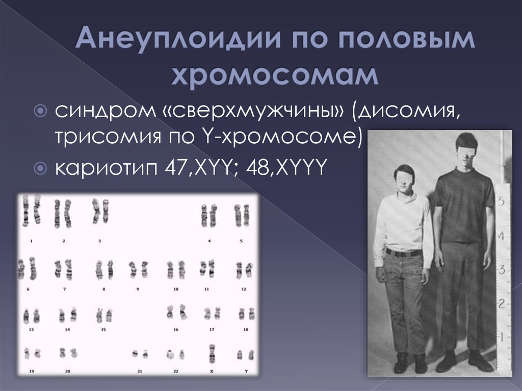 Х хромосома это мужская. Синдром трисомии кариотип 47. Полисомия по y-хромосоме симптомы. Синдром дисомии по y-хромосоме. Синдром Клайнфельтера трисомия.
