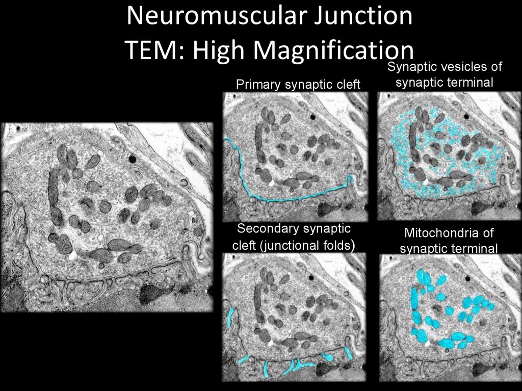 Neuromuscular Junction TEM: High Magnification