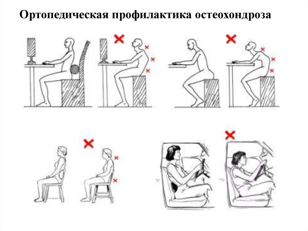 Почему нельзя сидеть в туалете. Правильная поза для сидения. Правильная поза сидя. Неправильные позы для сидения. Удобные позы для чтения.
