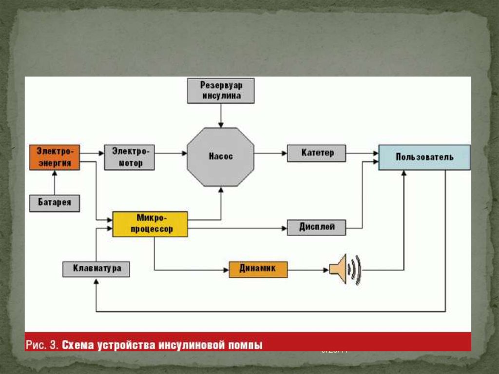 Инсулиновые помпы презентация