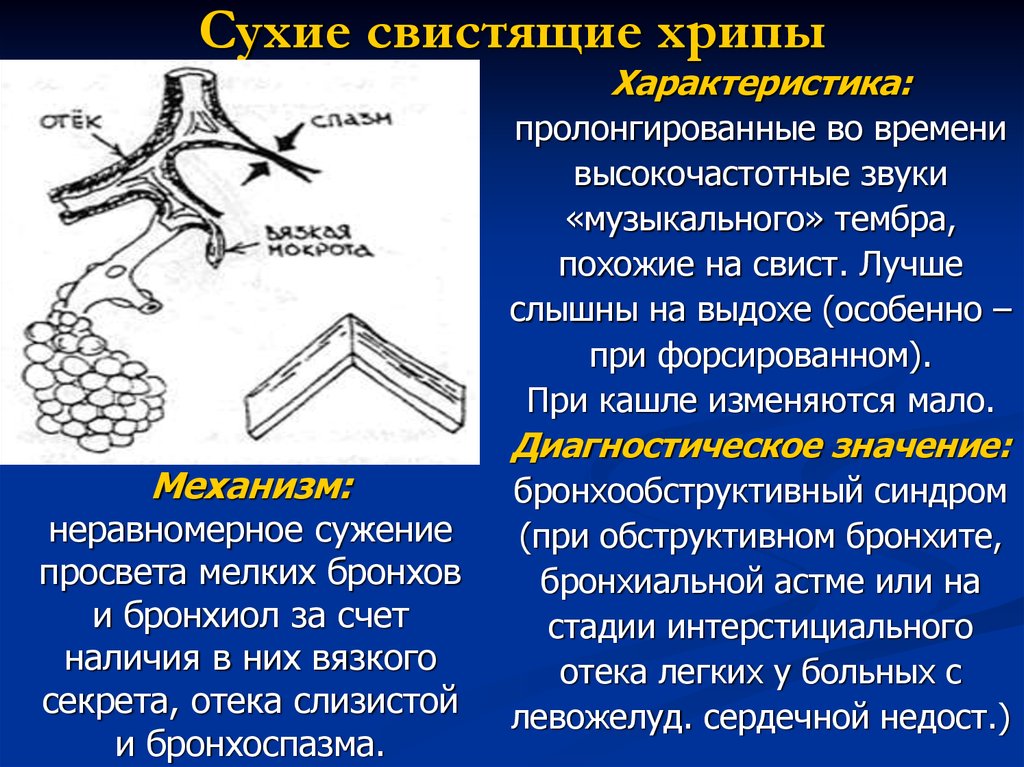 Хрипы в легких звук. Свистящие хрипы при аускультации. Сухие свистящие хрипы. Механизм образования сухих и влажных хрипов.