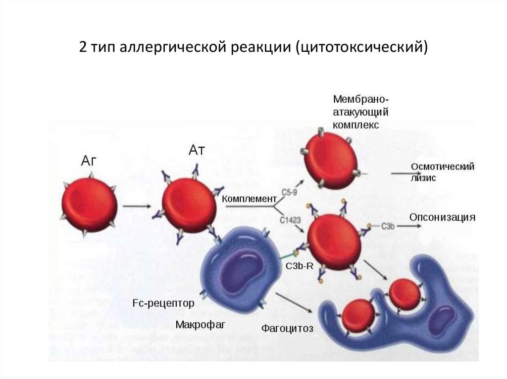 Иммунная аллергическая реакция. Гемолитическая анемия патогенез схема. Гемолитическая анемия Тип аллергической реакции. Патогенез аутоиммунных анемий. Аутоиммунная гемолитическая анемия схема.