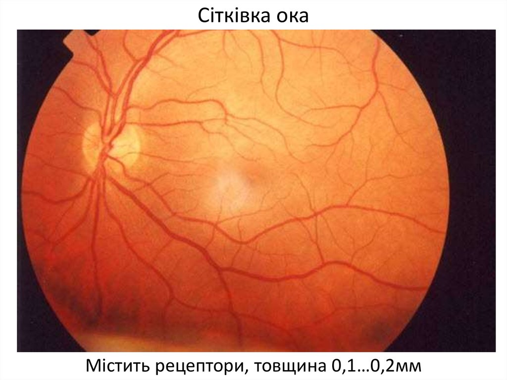 На сетчатку глаза за 3 с. Отслоение сетчатки глазное дно. Экссудативная отслойка сетчатки глаза. Тотальная отслойка сетчатки. Ангиосклероз сетчатки.